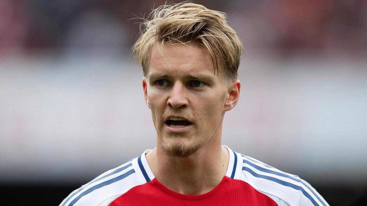 “I’m feeling more positive every day” : Martin Odegaard provides an update on his injury